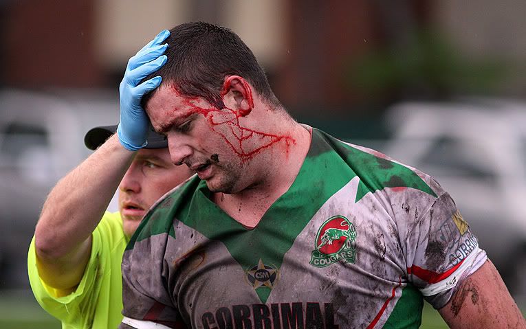 IMAGE: http://i177.photobucket.com/albums/w207/robsheeley/BVCFB11.jpg